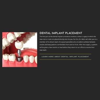 dental implant illustration